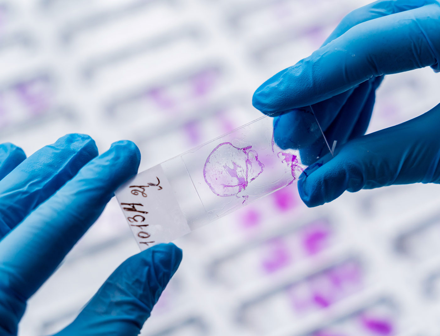 Person holding a lab slide for a microscope